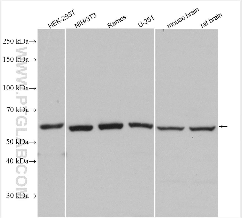 Western Blot (WB) analysis of various lysates using Beta TRCP Polyclonal antibody (28393-1-AP)