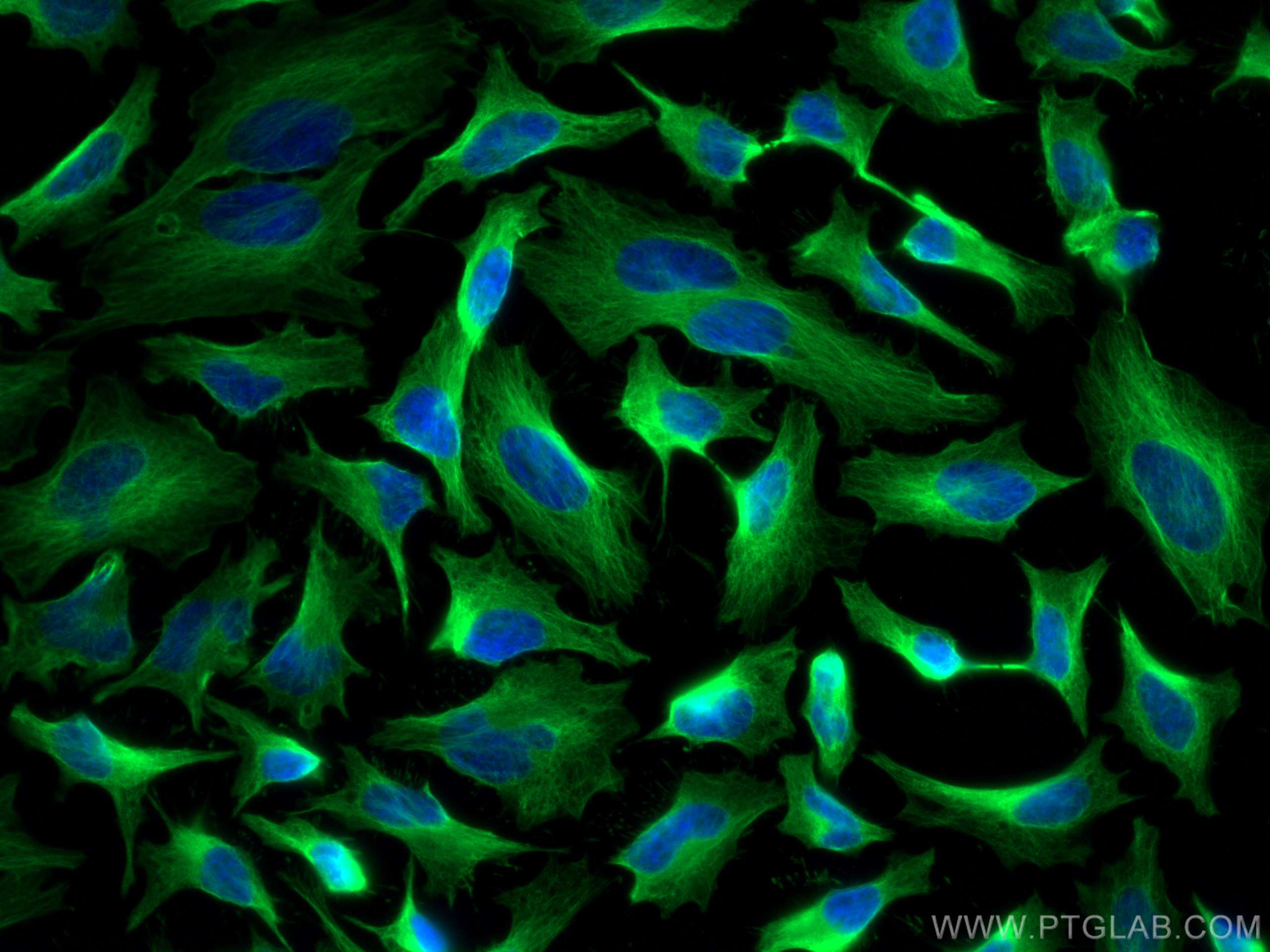 Immunofluorescence (IF) / fluorescent staining of HeLa cells using Beta Tubulin Recombinant antibody (80713-1-RR)