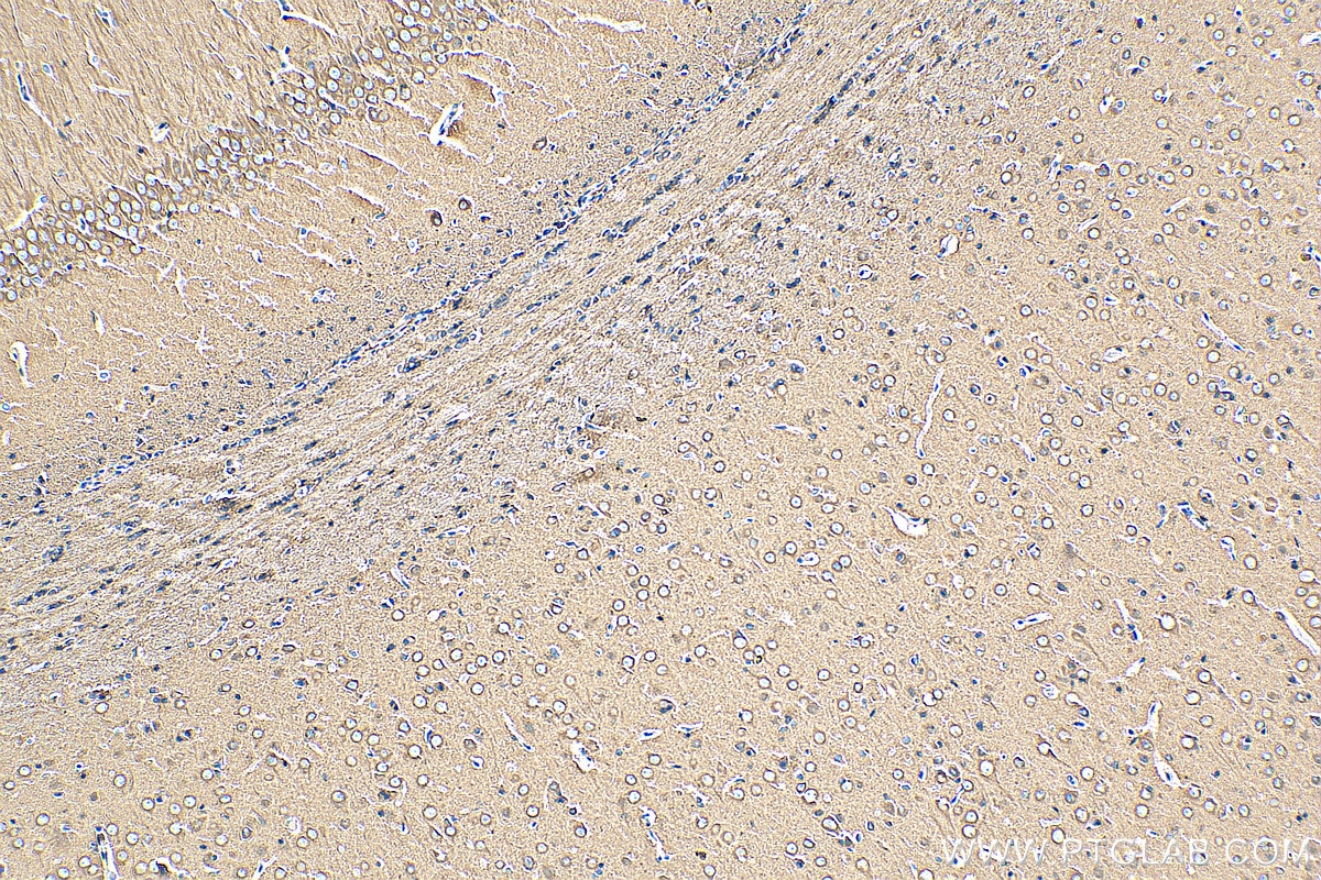 Immunohistochemistry (IHC) staining of rat brain tissue using Beta Tubulin Recombinant antibody (80713-1-RR)