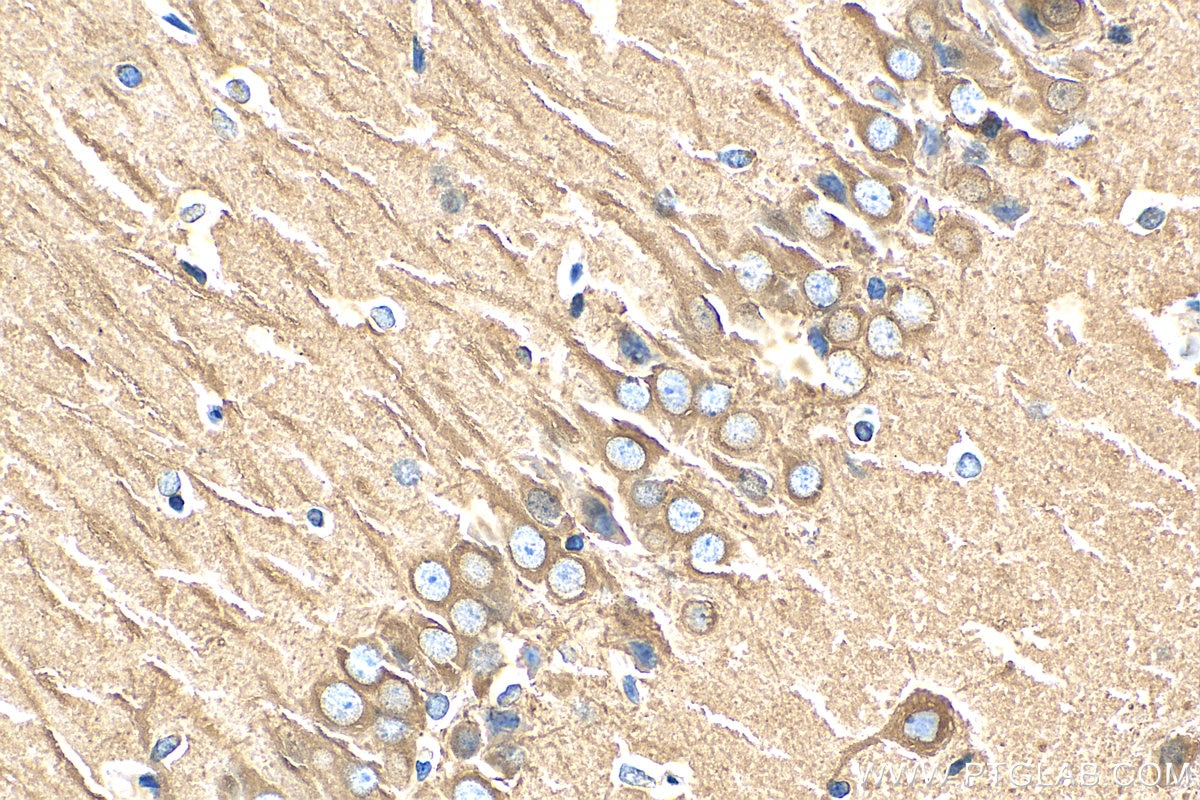 Immunohistochemistry (IHC) staining of rat brain tissue using Beta Tubulin Recombinant antibody (80713-1-RR)