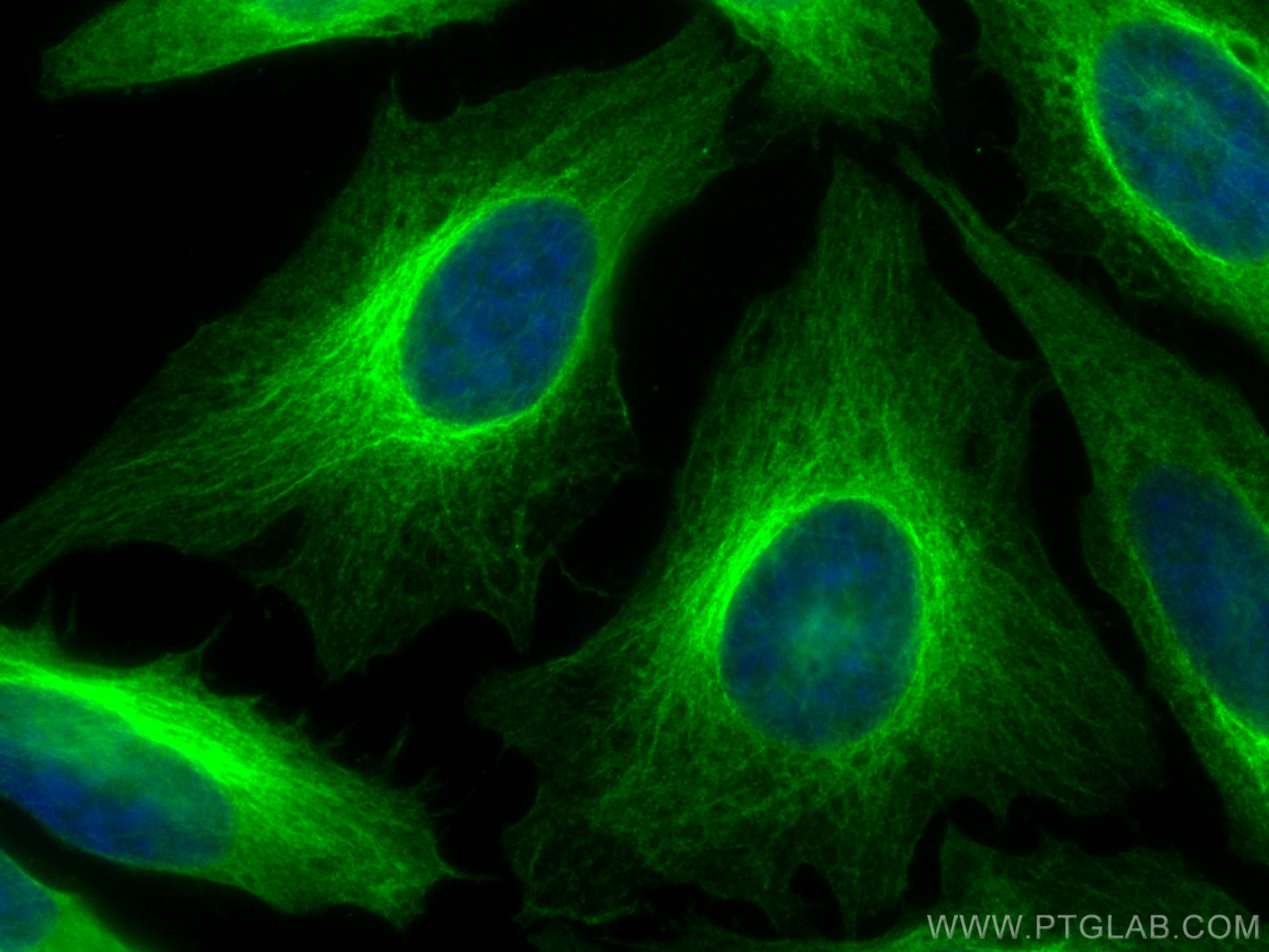 Immunofluorescence (IF) / fluorescent staining of HeLa cells using CoraLite® Plus 488-conjugated Beta Tubulin Recombi (CL488-80713)