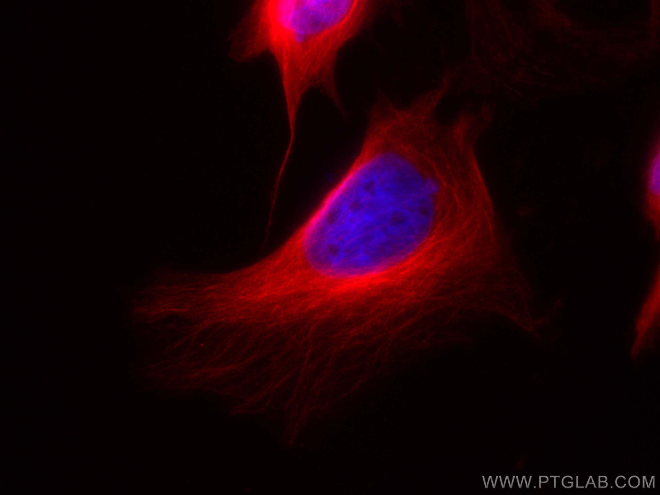 Immunofluorescence (IF) / fluorescent staining of HeLa cells using CoraLite®594-conjugated Beta Tubulin Polyclonal an (CL594-10068)