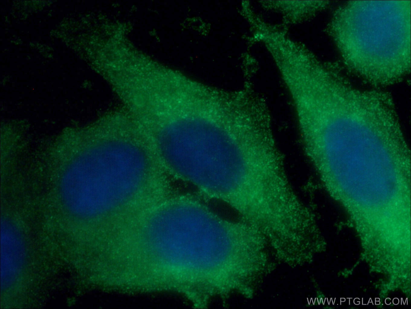 Immunofluorescence (IF) / fluorescent staining of HepG2 cells using Beta Galactosidase Monoclonal antibody (66586-1-Ig)