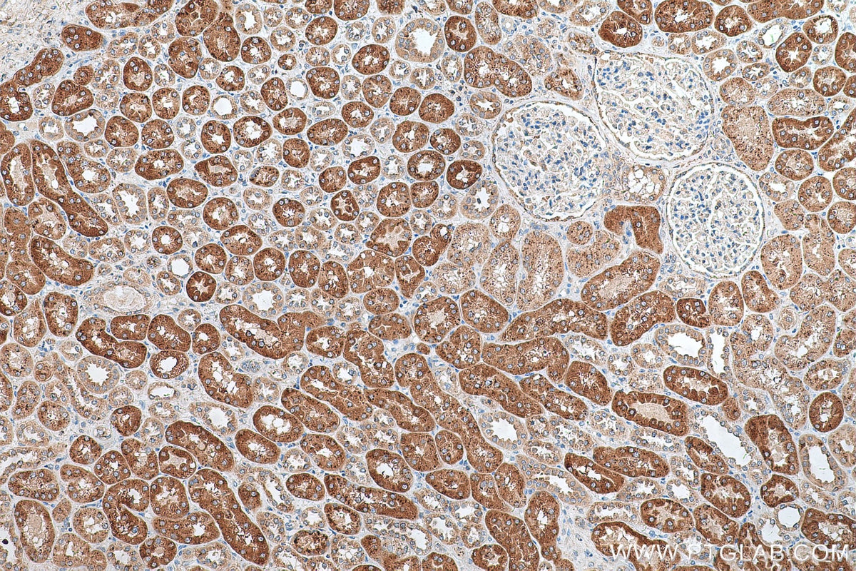 Immunohistochemistry (IHC) staining of human kidney tissue using Beta Galactosidase Monoclonal antibody (66586-1-Ig)