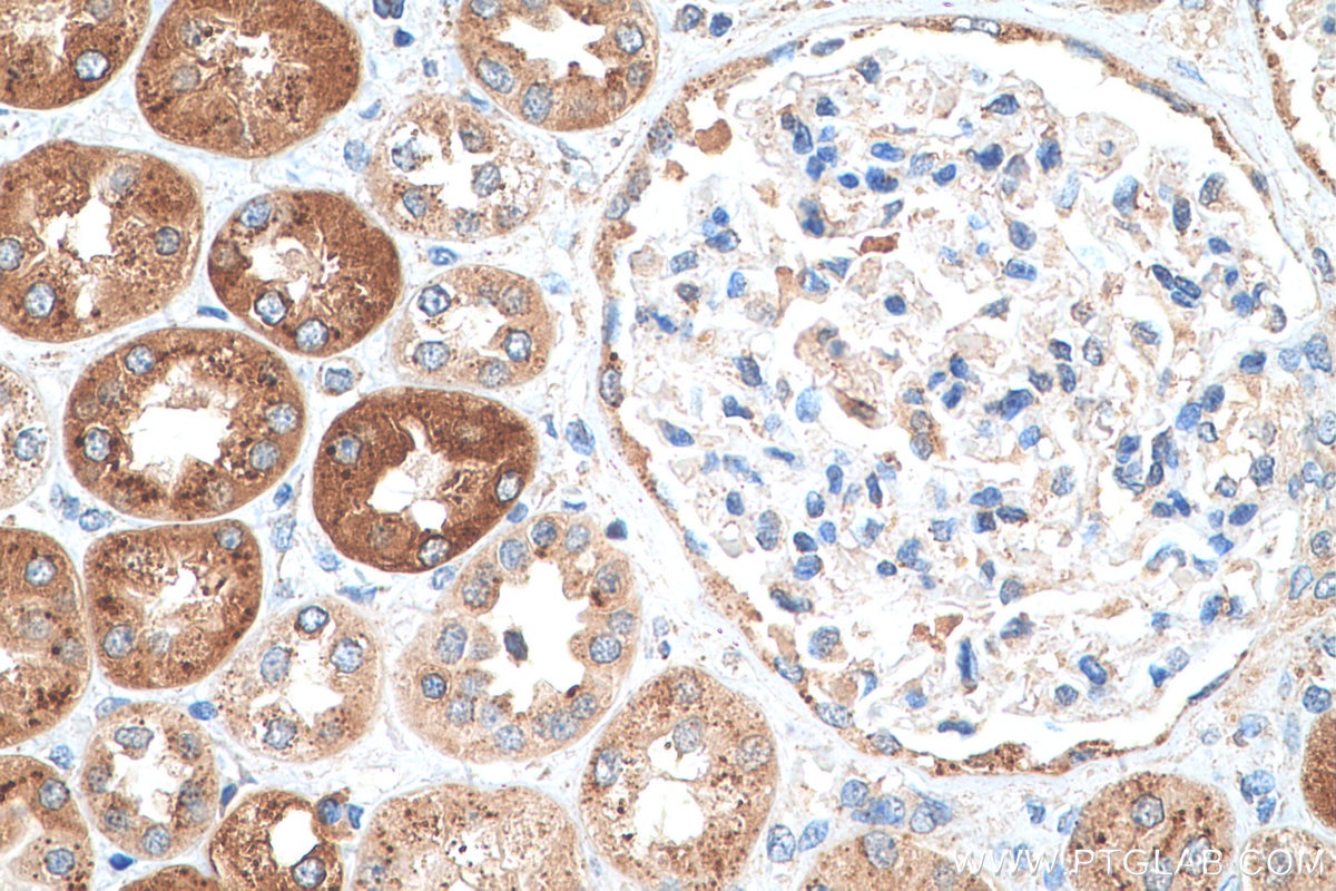 Immunohistochemistry (IHC) staining of human kidney tissue using Beta Galactosidase Monoclonal antibody (66586-1-Ig)