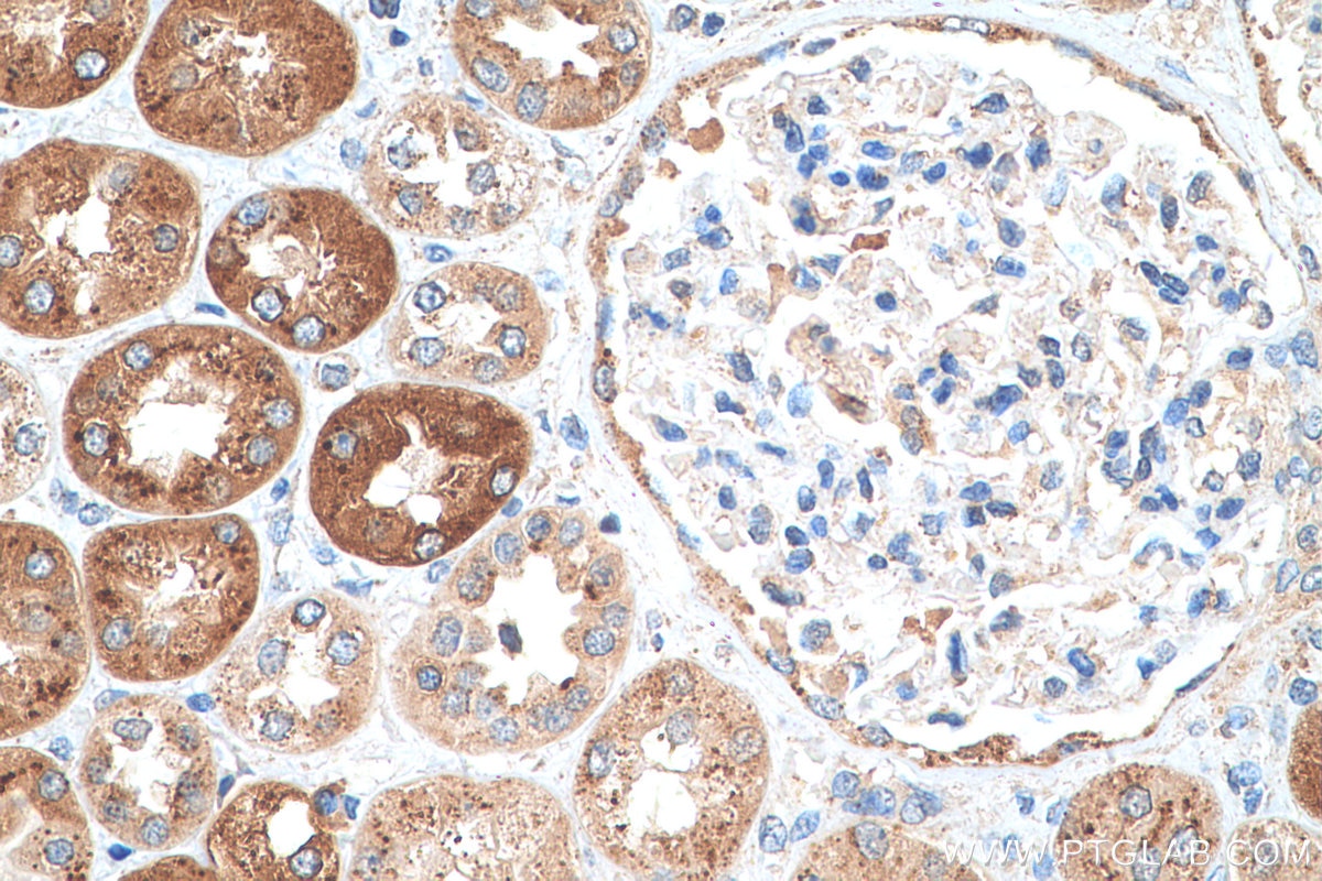 IHC staining of human kidney using 66586-1-Ig