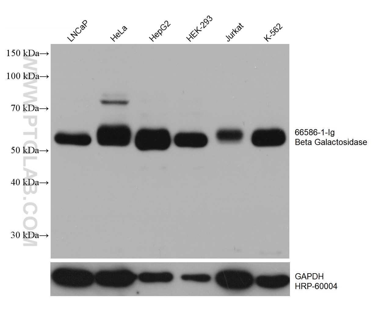 Western Blot (WB) analysis of various lysates using Beta Galactosidase Monoclonal antibody (66586-1-Ig)