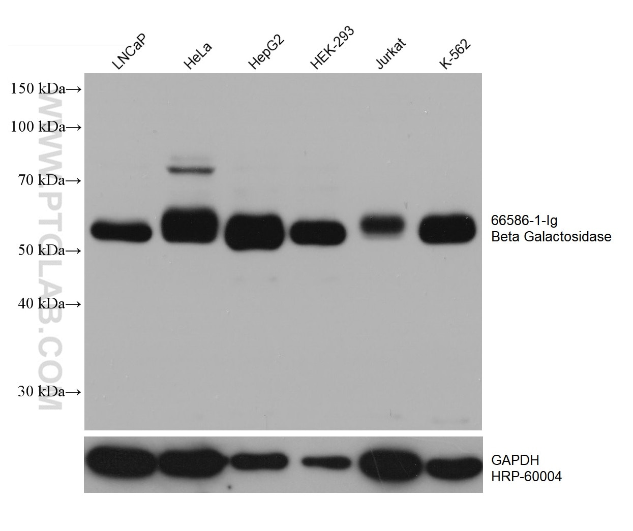 WB analysis using 66586-1-Ig