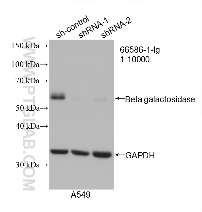 Western Blot (WB) analysis of A549 cells using Beta Galactosidase Monoclonal antibody (66586-1-Ig)