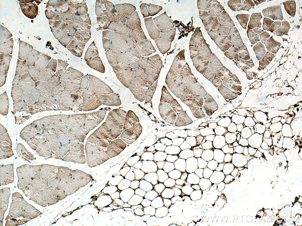 Immunohistochemistry (IHC) staining of mouse skeletal muscle tissue using Osteocalcin Polyclonal antibody (20277-1-AP)