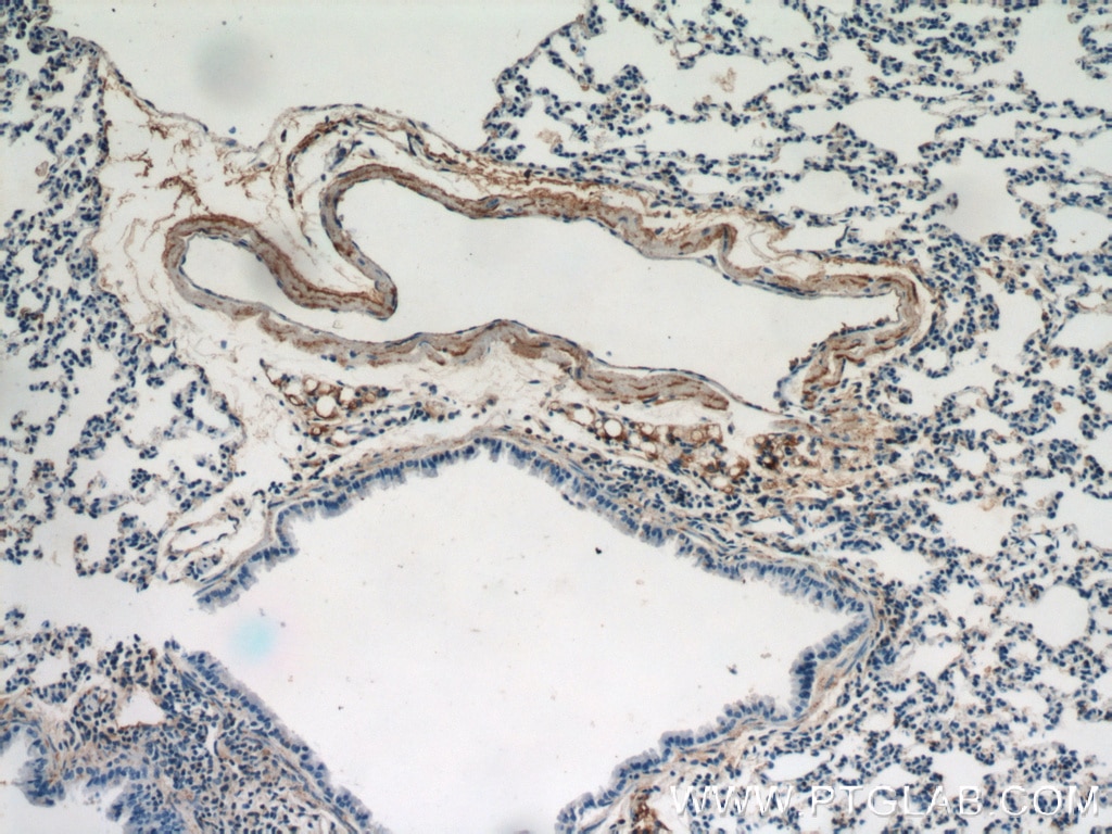 Immunohistochemistry (IHC) staining of mouse lung tissue using Osteocalcin Polyclonal antibody (20277-1-AP)