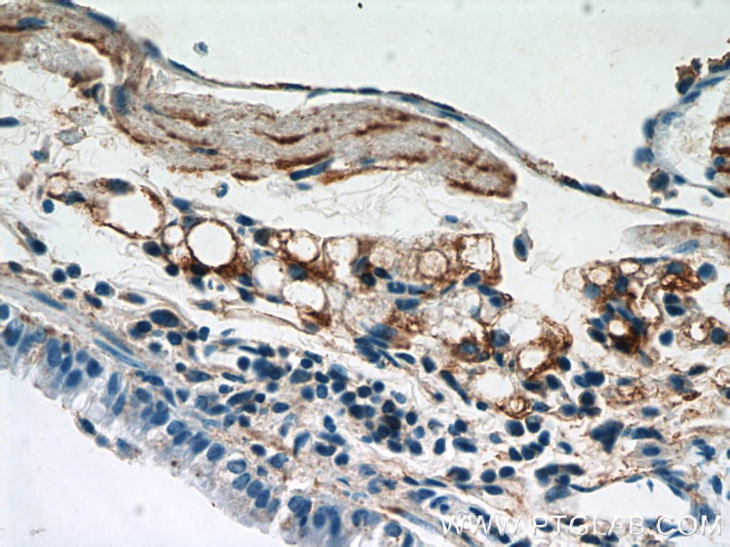 Immunohistochemistry (IHC) staining of mouse lung tissue using Osteocalcin Polyclonal antibody (20277-1-AP)