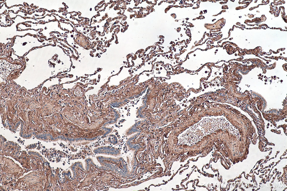 Immunohistochemistry (IHC) staining of human lung tissue using Biglycan Monoclonal antibody (67275-1-Ig)
