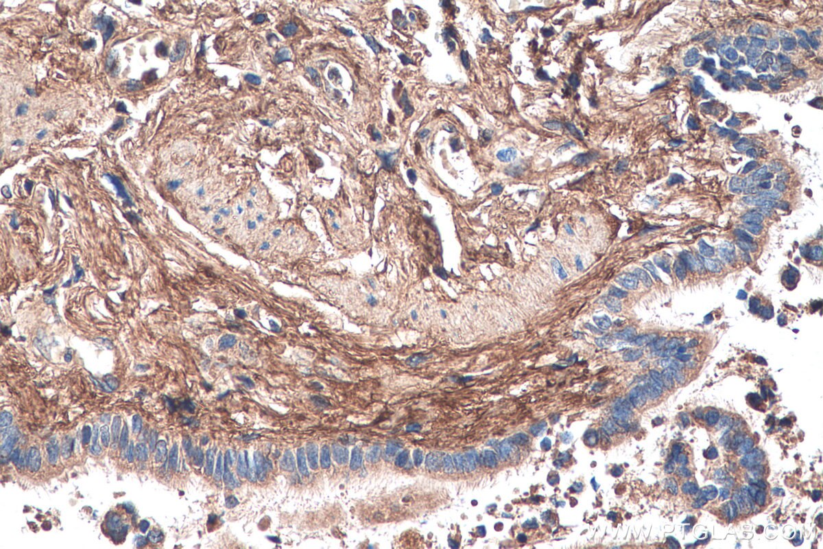 Immunohistochemistry (IHC) staining of human lung tissue using Biglycan Monoclonal antibody (67275-1-Ig)