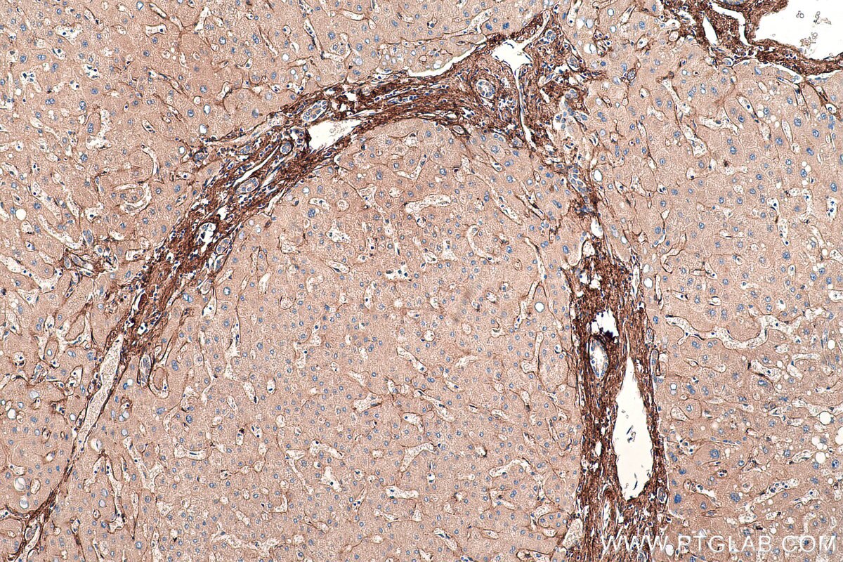 Immunohistochemistry (IHC) staining of human liver tissue using Biglycan Monoclonal antibody (67275-1-Ig)