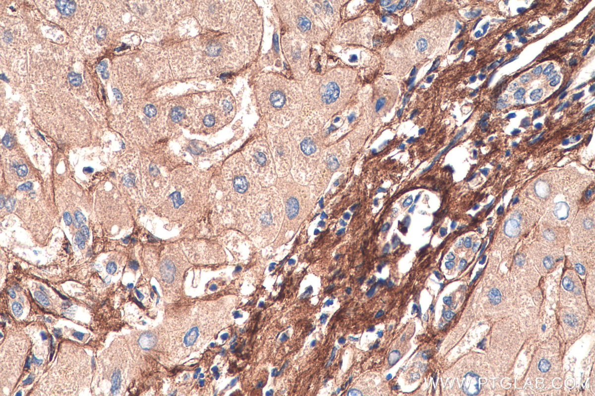 Immunohistochemistry (IHC) staining of human liver tissue using Biglycan Monoclonal antibody (67275-1-Ig)