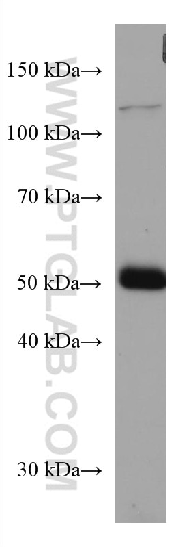 Western Blot (WB) analysis of mouse testis tissue using Biglycan Monoclonal antibody (67275-1-Ig)