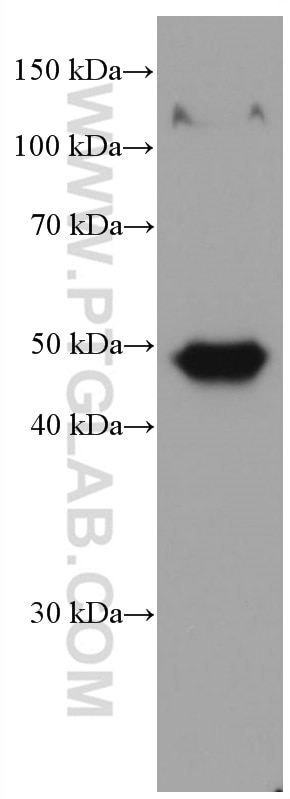 Western Blot (WB) analysis of pig skin tissue using Biglycan Monoclonal antibody (67275-1-Ig)