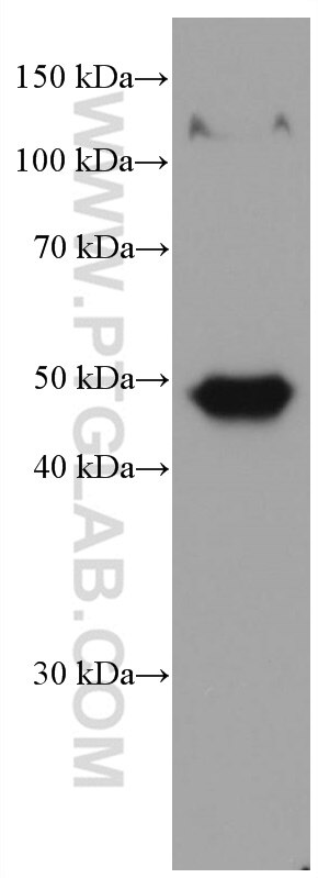 WB analysis of pig skin using 67275-1-Ig