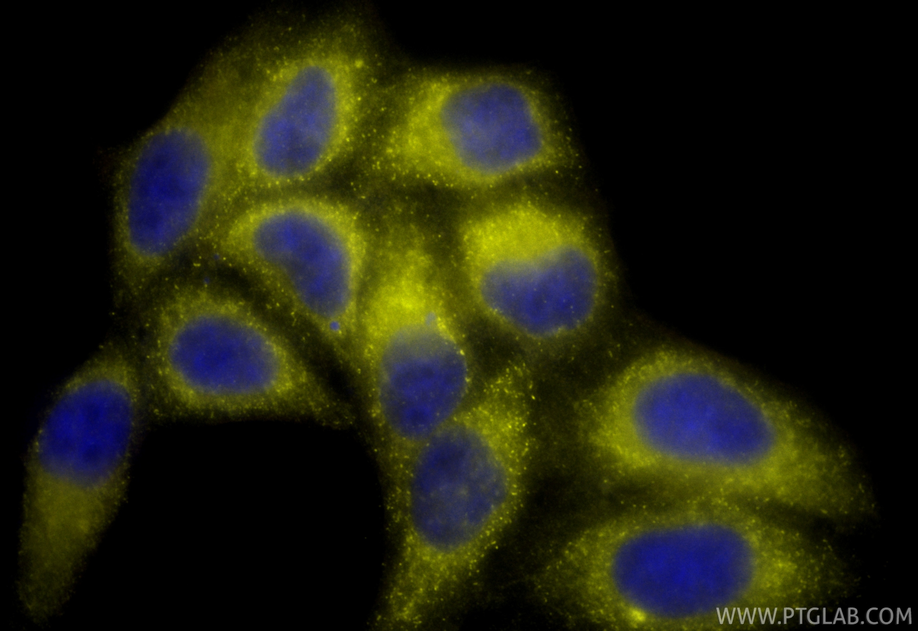 Immunofluorescence (IF) / fluorescent staining of HepG2 cells using PE Anti-Biotin Rabbit Recombinant Antibody (PE-98598)
