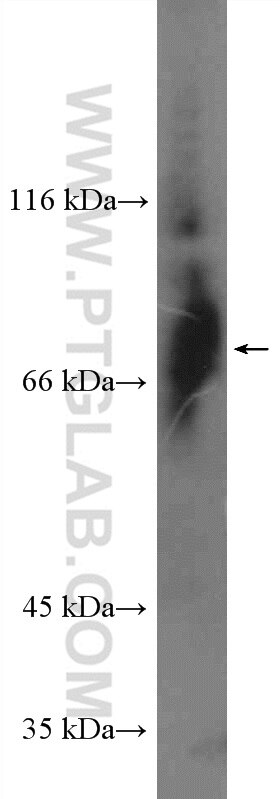 Western Blot (WB) analysis of Jurkat cells using Bora Polyclonal antibody (26866-1-AP)