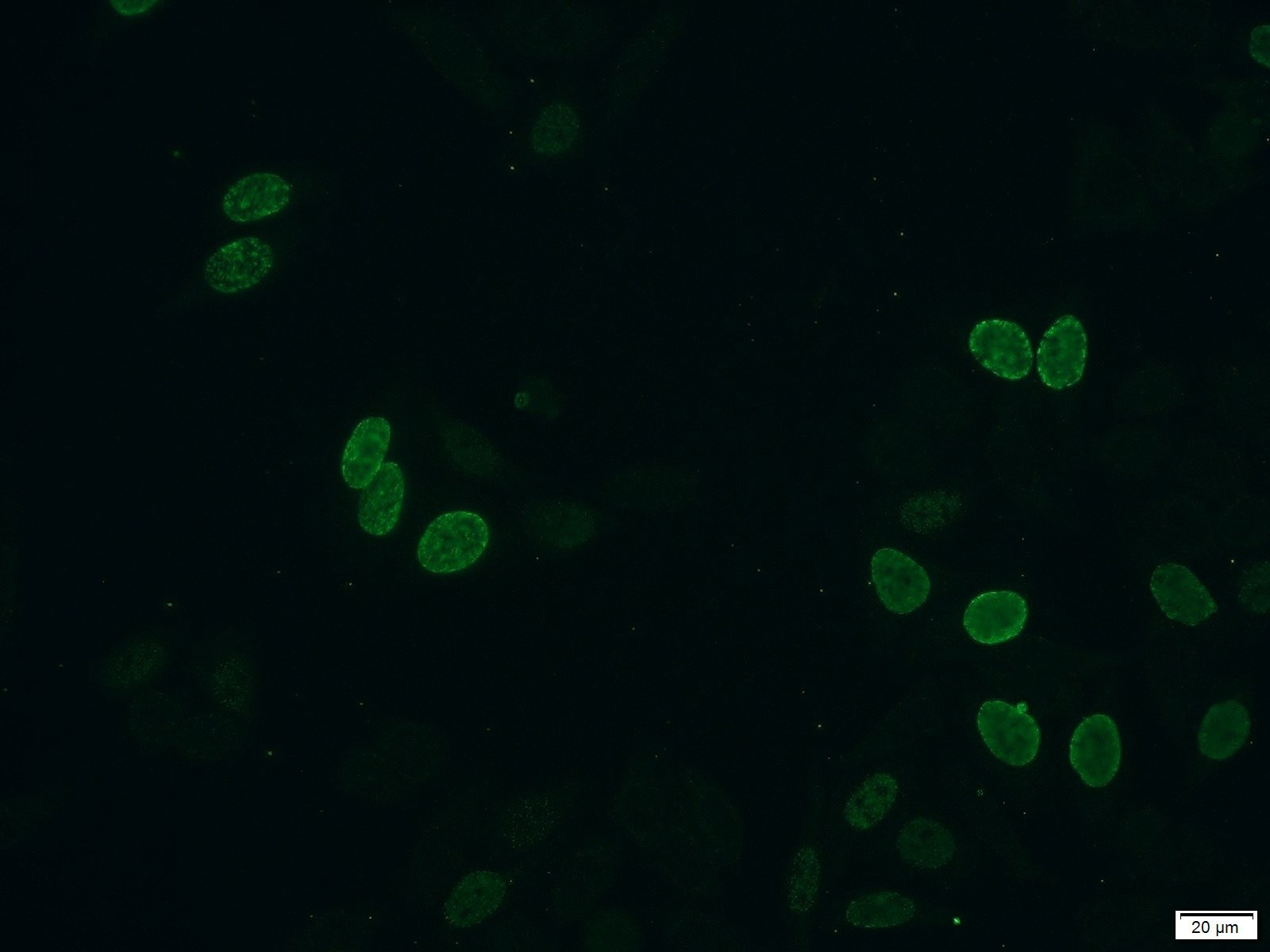 Immunofluorescence (IF) / fluorescent staining of HeLa cells using BrdU Monoclonal antibody (66241-1-Ig)