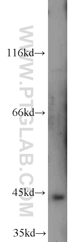 Western Blot (WB) analysis of mouse liver tissue using TBXT Polyclonal antibody (20741-1-AP)