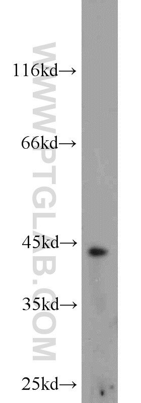 Western Blot (WB) analysis of mouse liver tissue using TBXT Polyclonal antibody (20741-1-AP)