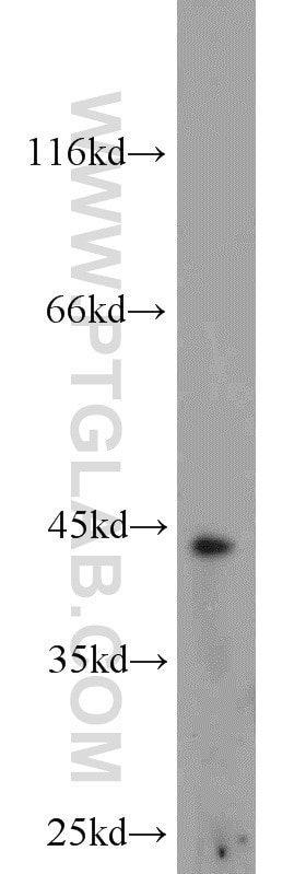 Western Blot (WB) analysis of mouse liver tissue using TBXT Polyclonal antibody (20741-1-AP)