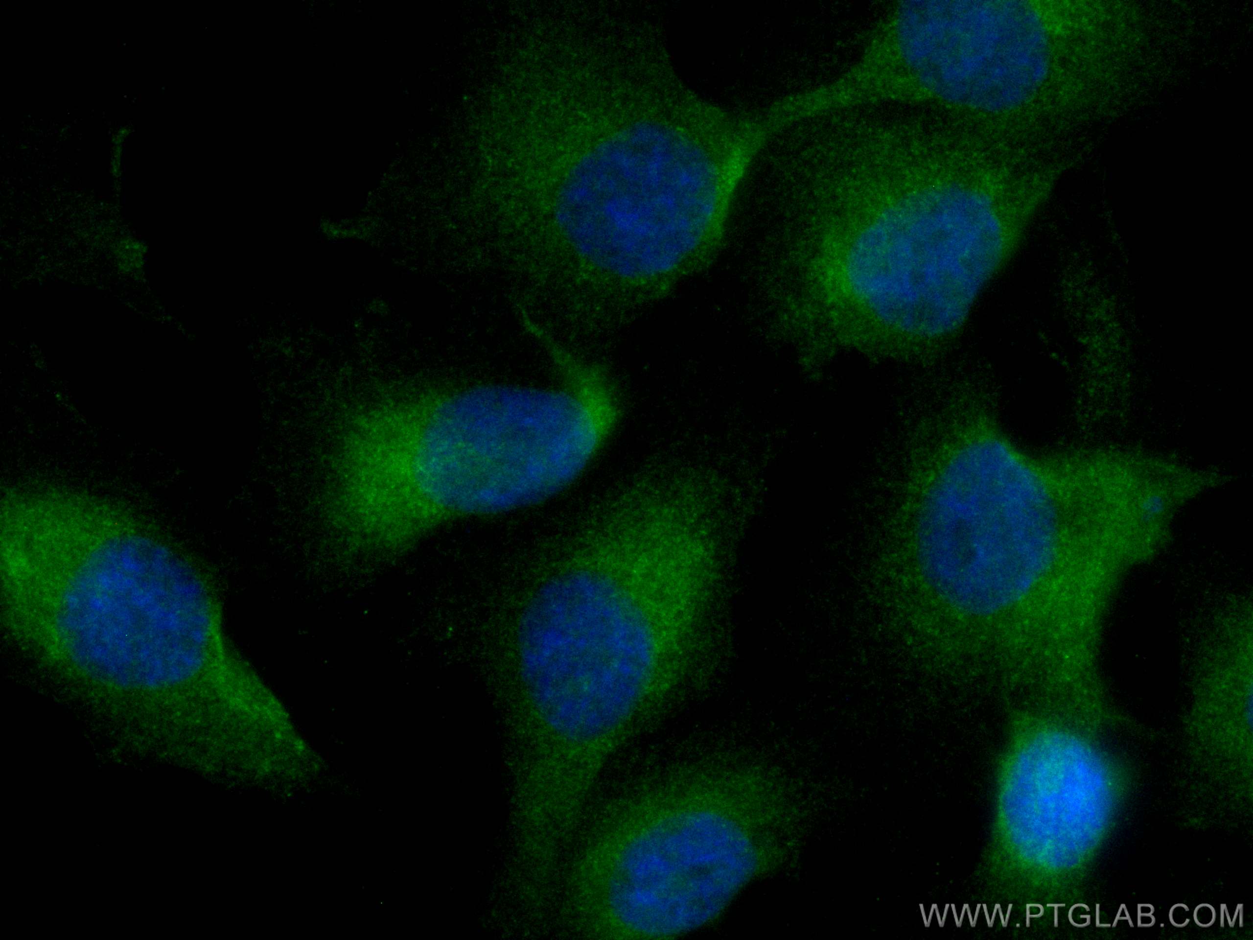 Immunofluorescence (IF) / fluorescent staining of SKOV-3 cells using CoraLite® Plus 488-conjugated BubR1 Polyclonal ant (CL488-11504)