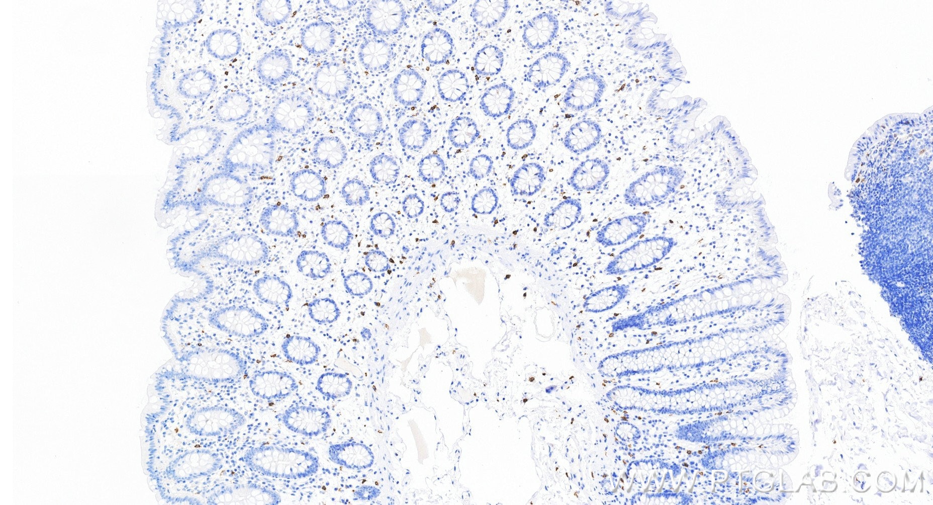 IHC staining of human colon using 84259-11-RR (same clone as 84259-11-PBS) Immunohistochemistry (IHC) staining of human colon tissue using CD117/c-Kit Recombinant monoclonal antibody (84259-11-RR)