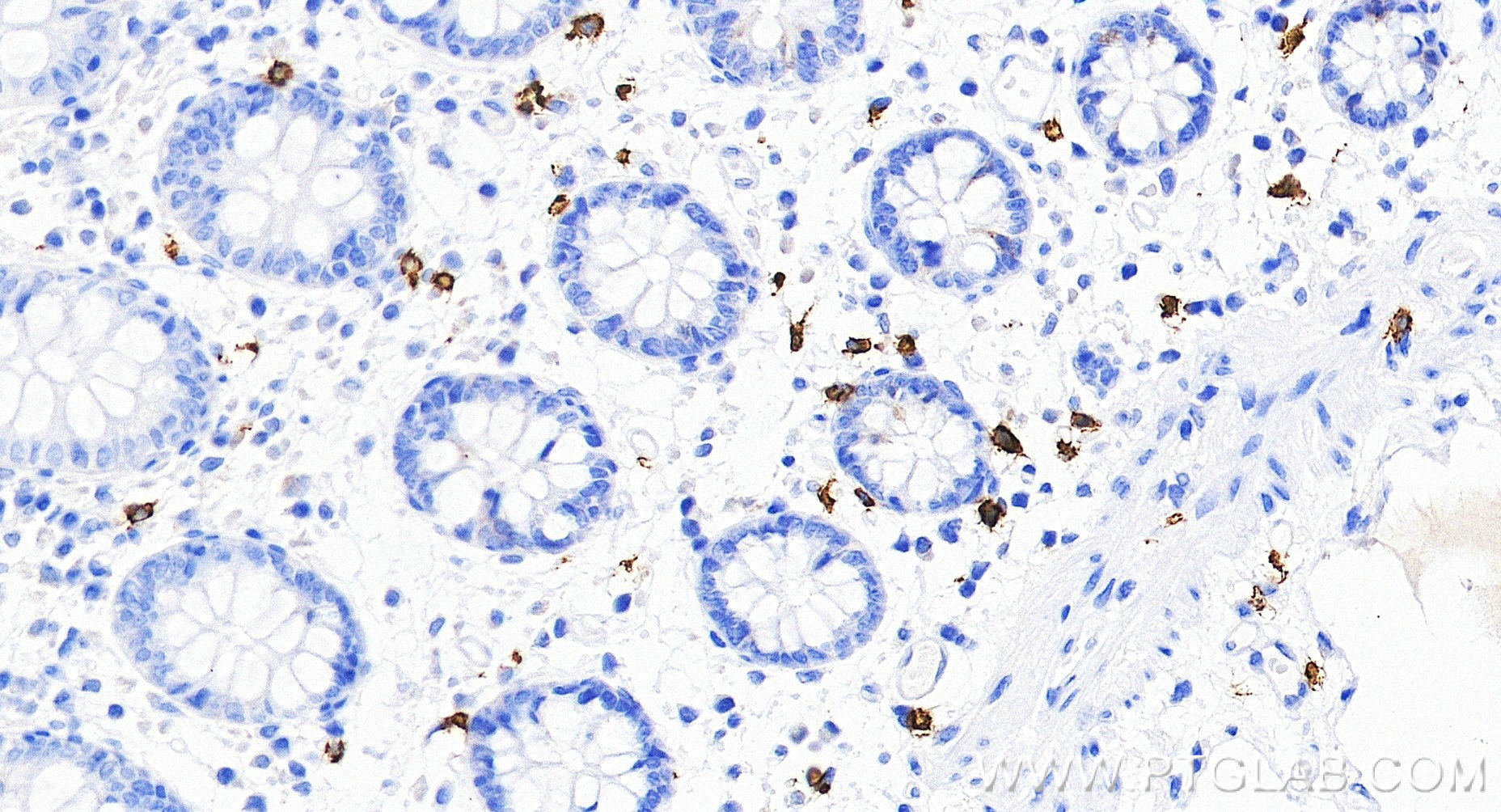 IHC staining of human colon using 84259-11-RR (same clone as 84259-11-PBS) Immunohistochemistry (IHC) staining of human colon tissue using CD117/c-Kit Recombinant monoclonal antibody (84259-11-RR)