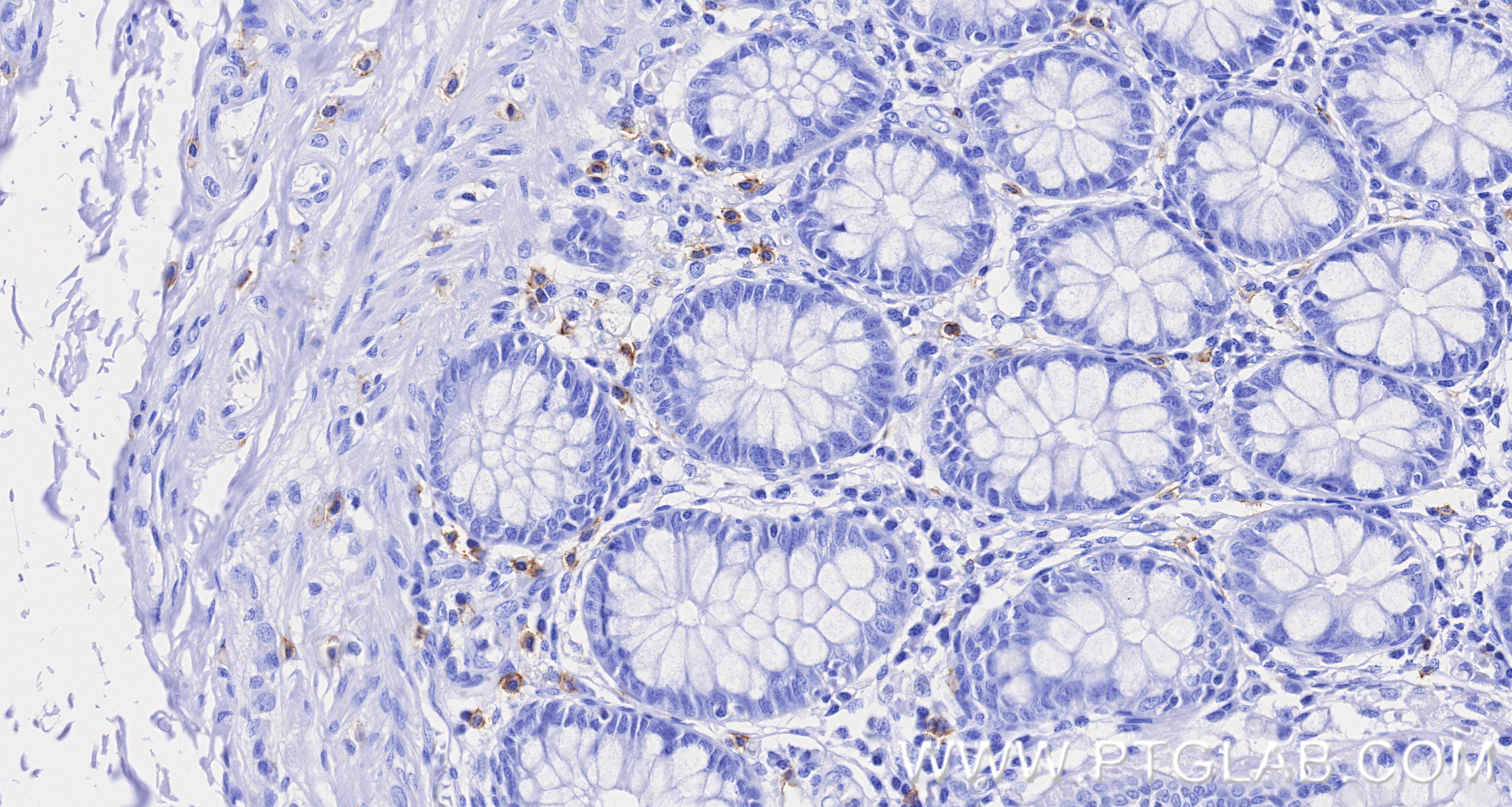 IHC staining of human colon using 84259-11-RR (same clone as 84259-11-PBS) Immunohistochemistry (IHC) staining of human colon tissue using CD117/c-Kit Recombinant monoclonal antibody (84259-11-RR)