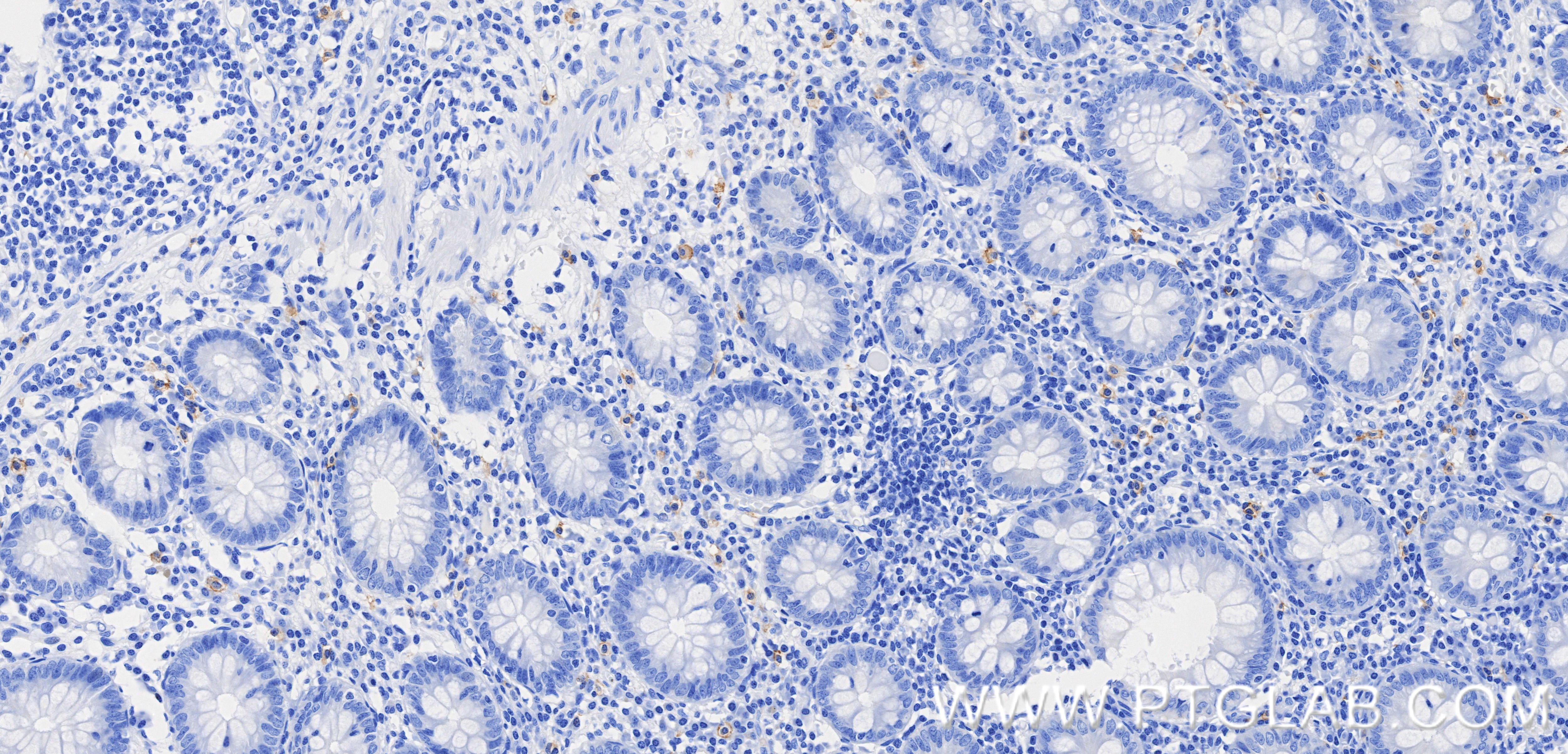 IHC staining of human appendix using 84259-11-RR (same clone as 84259-11-PBS) Immunohistochemistry (IHC) staining of human appendix tissue using CD117/c-Kit Recombinant monoclonal antibody (84259-11-RR)