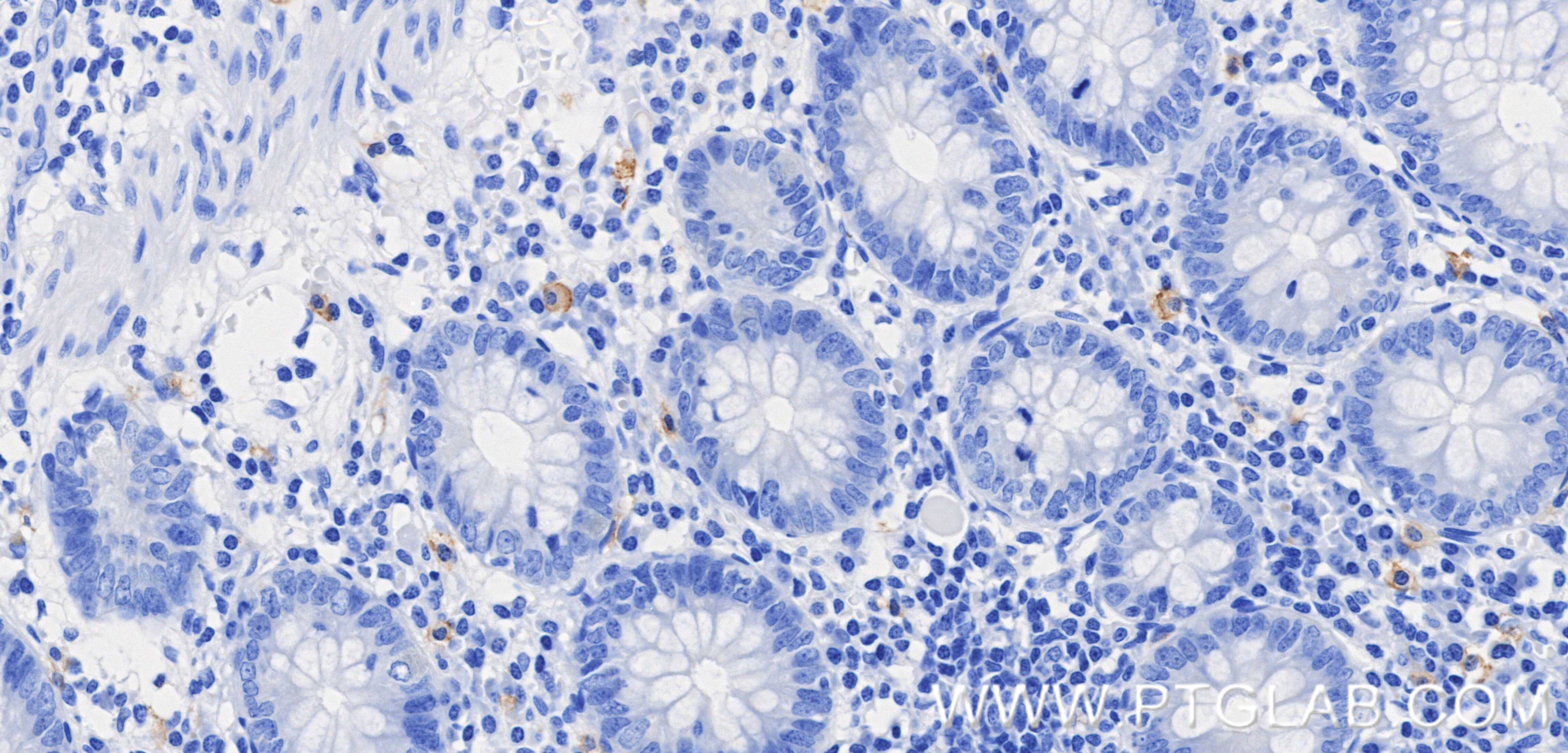 IHC staining of human appendix using 84259-11-RR (same clone as 84259-11-PBS) Immunohistochemistry (IHC) staining of human appendix tissue using CD117/c-Kit Recombinant monoclonal antibody (84259-11-RR)