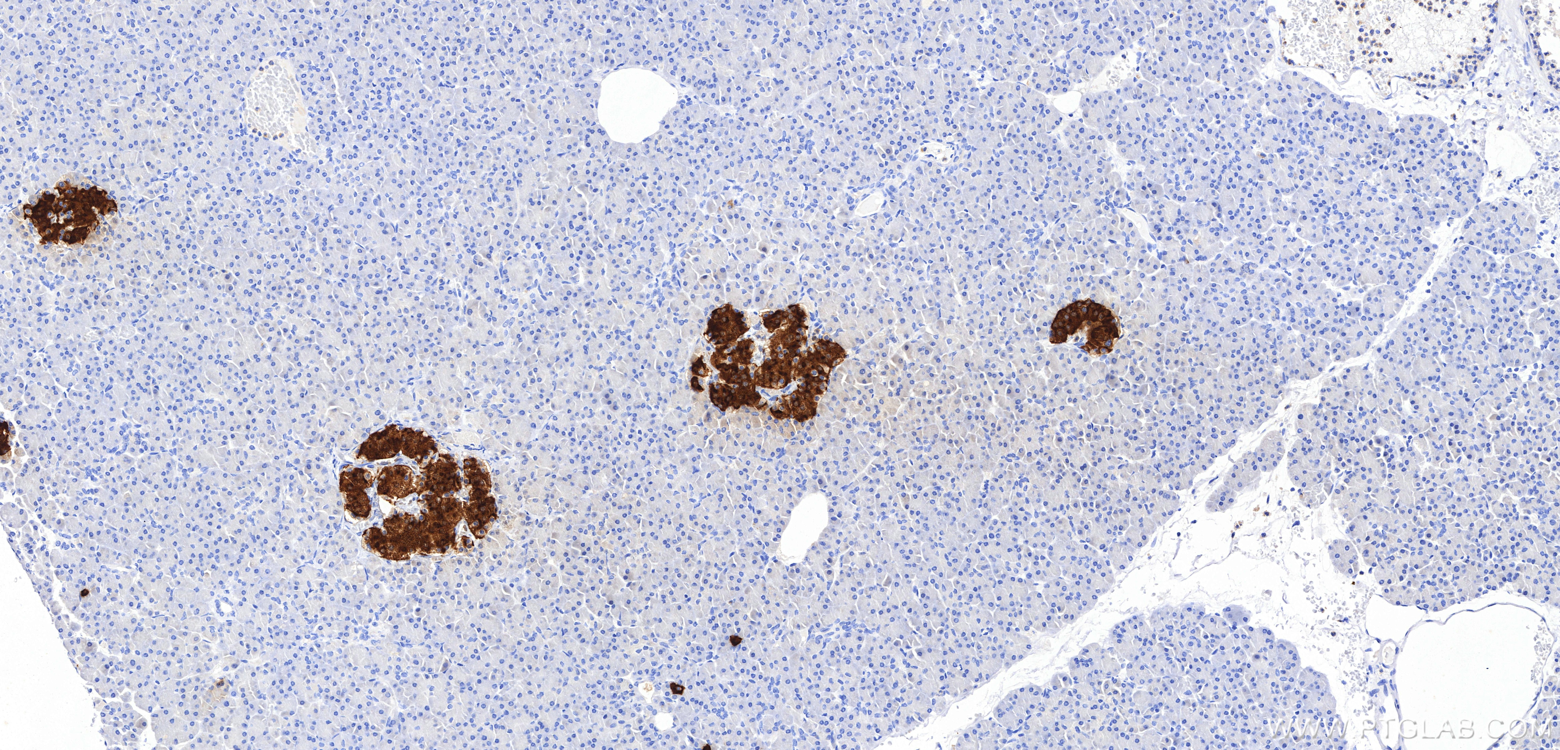 IHC staining of human pancreas using 98867-1-RR Immunohistochemistry (IHC) staining of human pancreas tissue using Anti-Human C-Peptide Rabbit Recombinant Antibody (98867-1-RR)