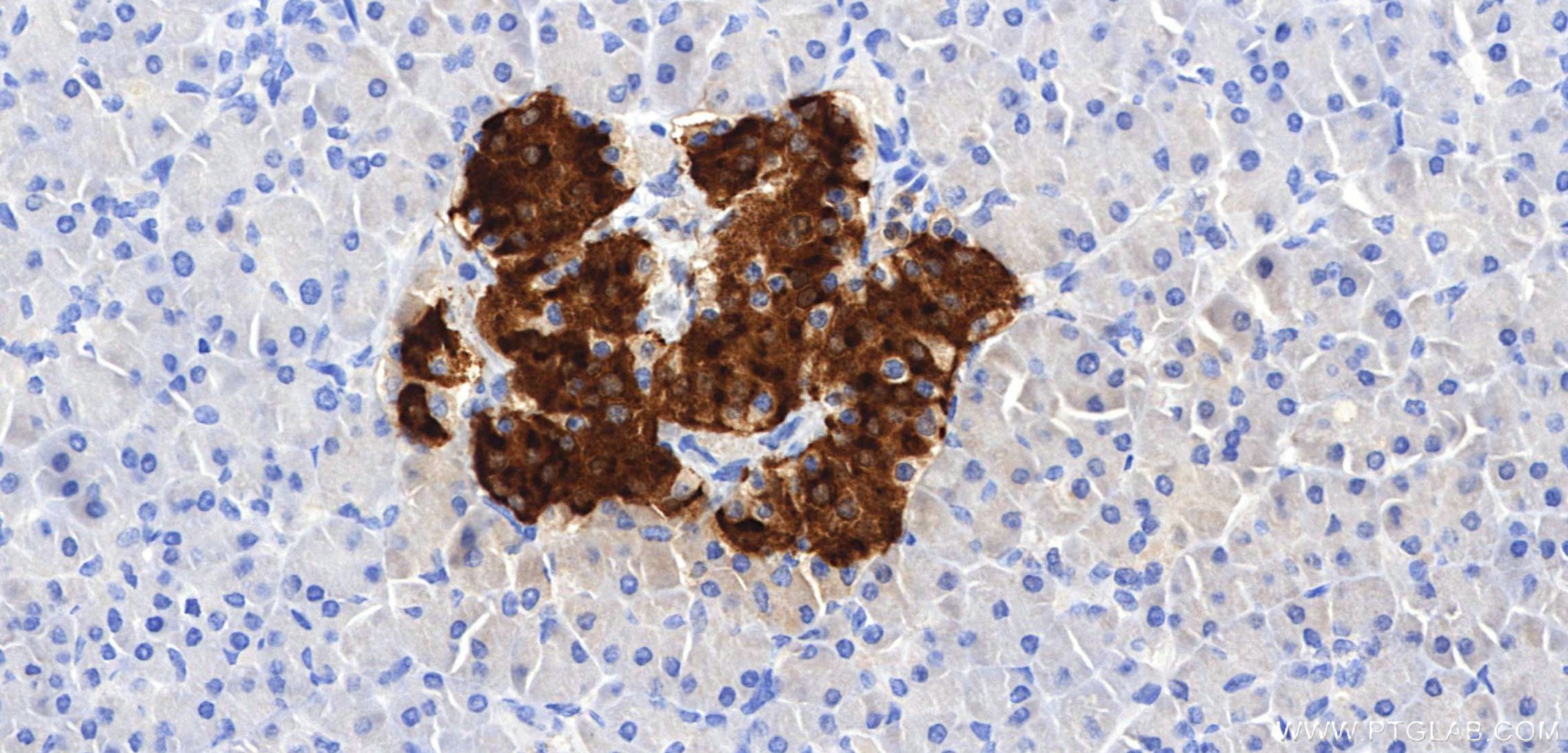 IHC staining of human pancreas using 98867-1-RR Immunohistochemistry (IHC) staining of human pancreas tissue using Anti-Human C-Peptide Rabbit Recombinant Antibody (98867-1-RR)