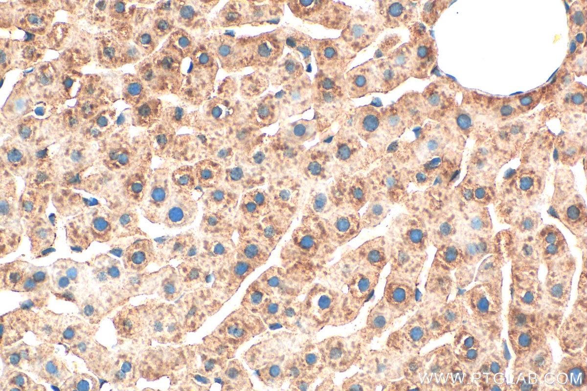 Immunohistochemistry (IHC) staining of rat liver tissue using C-Reactive Protein/CRP Polyclonal antibody (31251-1-AP)