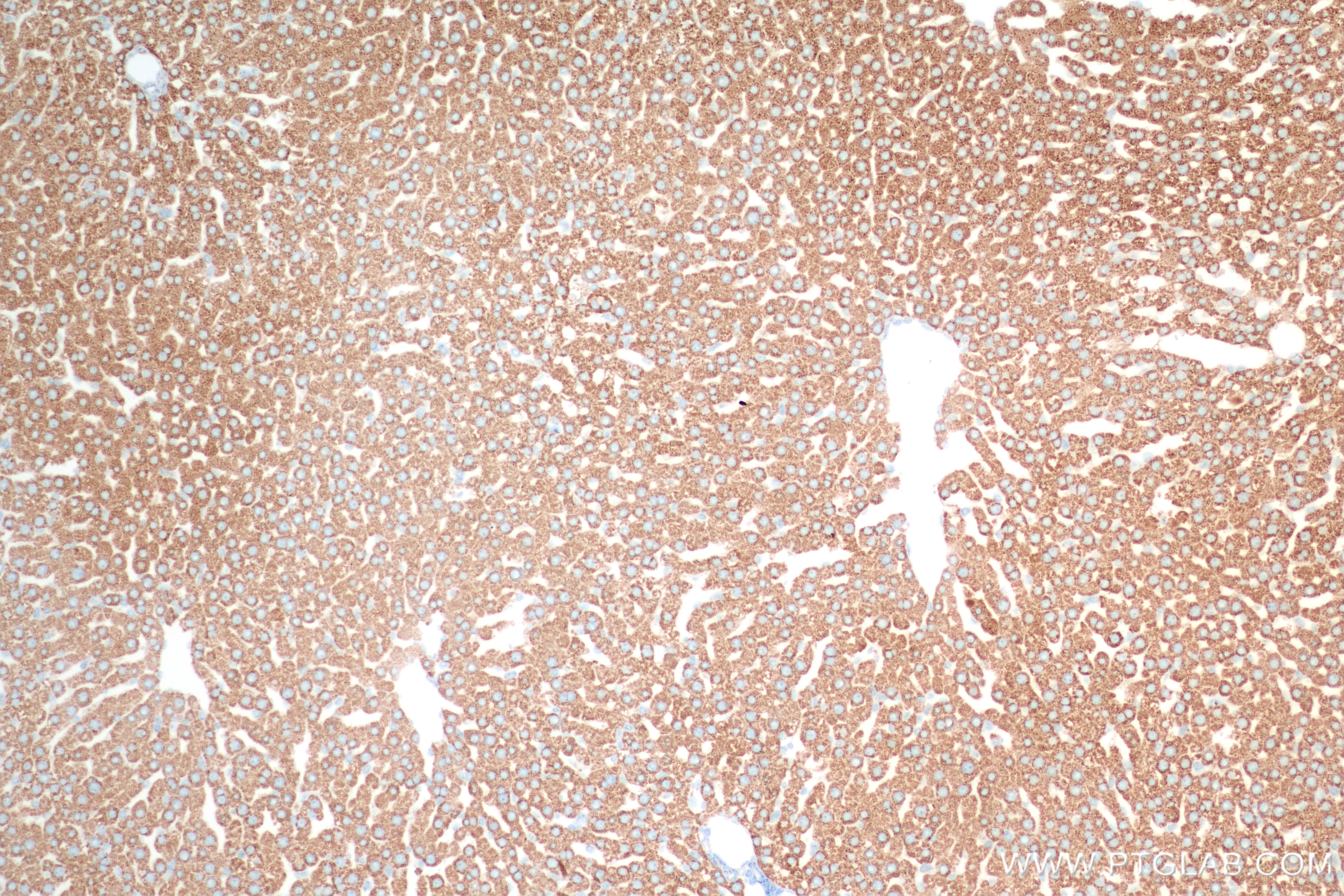 Immunohistochemistry (IHC) staining of rat liver tissue using C-Reactive Protein/CRP Recombinant antibody (83741-3-RR)