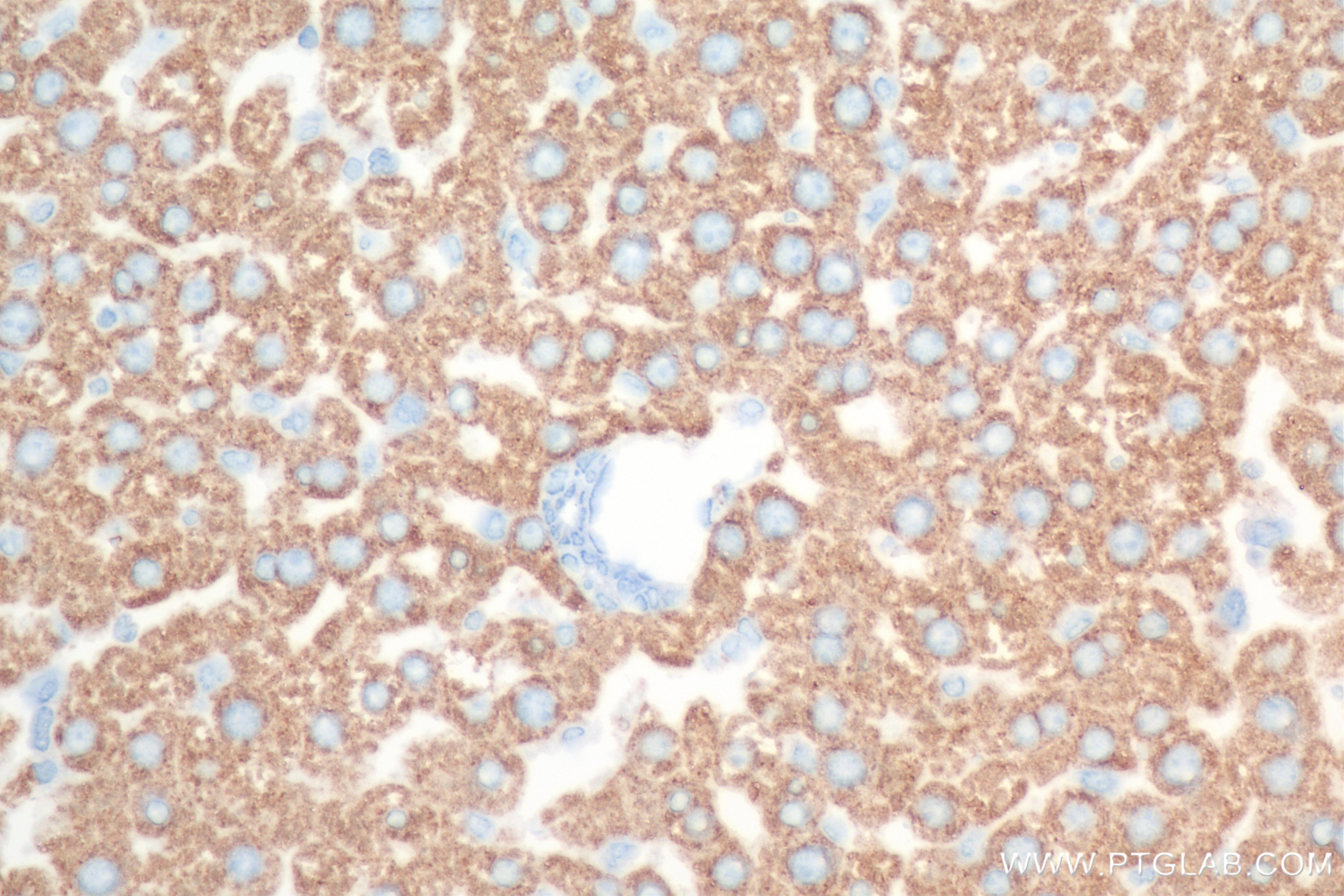 Immunohistochemistry (IHC) staining of rat liver tissue using C-Reactive Protein/CRP Recombinant antibody (83741-3-RR)
