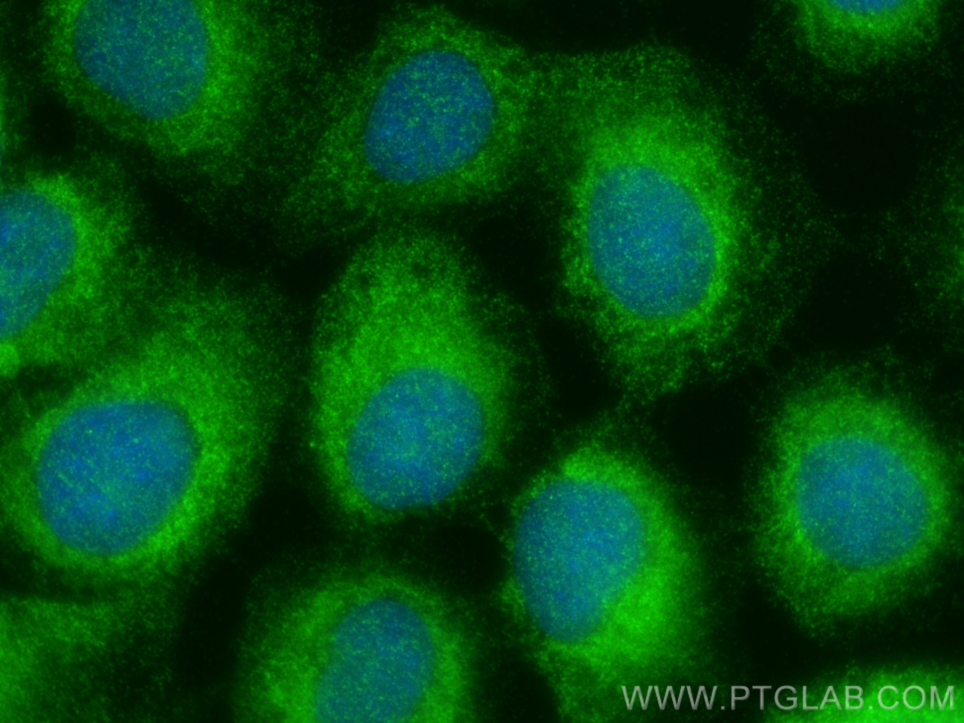 Immunofluorescence (IF) / fluorescent staining of A431 cells using C10orf104 Polyclonal antibody (26324-1-AP)