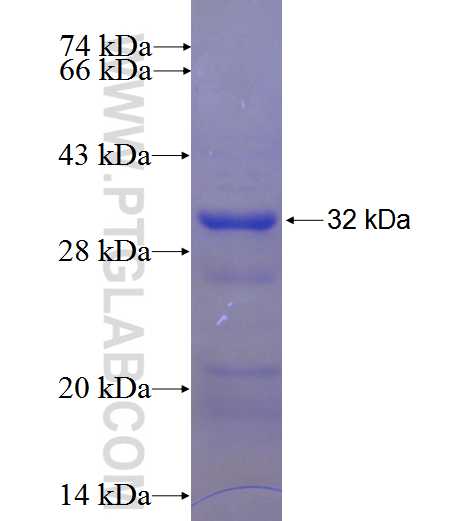 C10orf107 fusion protein Ag23756 SDS-PAGE
