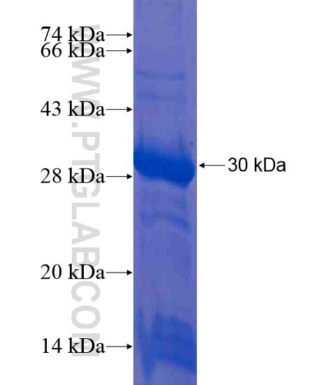 C10orf118 fusion protein Ag21351 SDS-PAGE