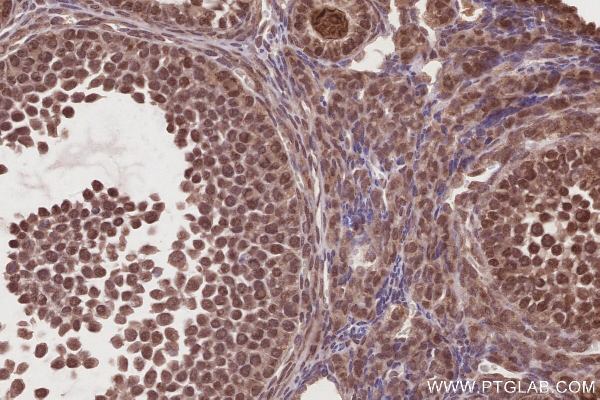 Immunohistochemistry (IHC) staining of mouse ovary tissue using MCM-BP Polyclonal antibody (19573-1-AP)