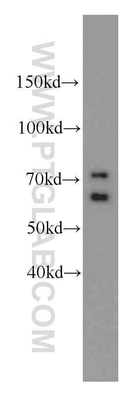 Western Blot (WB) analysis of HeLa cells using MCM-BP Polyclonal antibody (19573-1-AP)