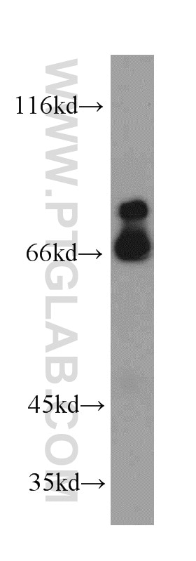 Western Blot (WB) analysis of HeLa cells using MCM-BP Polyclonal antibody (19573-1-AP)