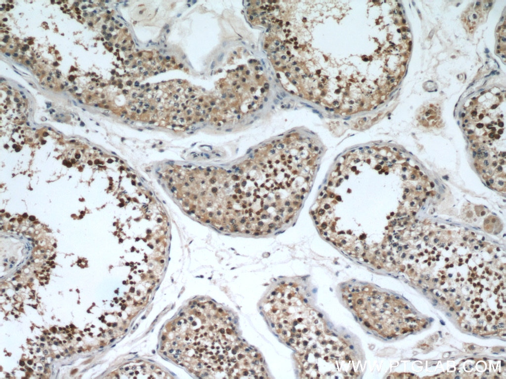 Immunohistochemistry (IHC) staining of human testis tissue using EDRF1 Polyclonal antibody (21883-1-AP)