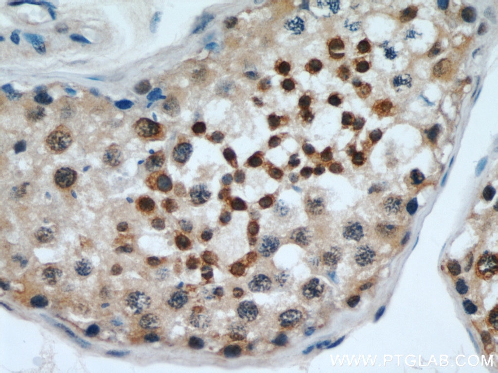 Immunohistochemistry (IHC) staining of human testis tissue using EDRF1 Polyclonal antibody (21883-1-AP)