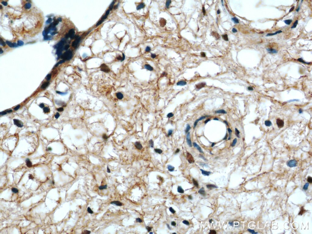 Immunohistochemistry (IHC) staining of human placenta tissue using EDRF1 Polyclonal antibody (21883-1-AP)