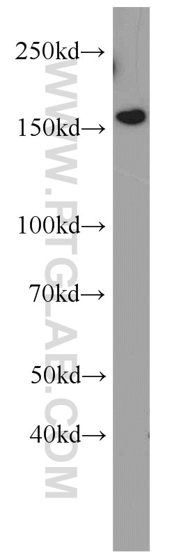 Western Blot (WB) analysis of human brain tissue using EDRF1 Polyclonal antibody (21883-1-AP)